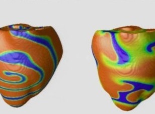 Jimenez cardiac